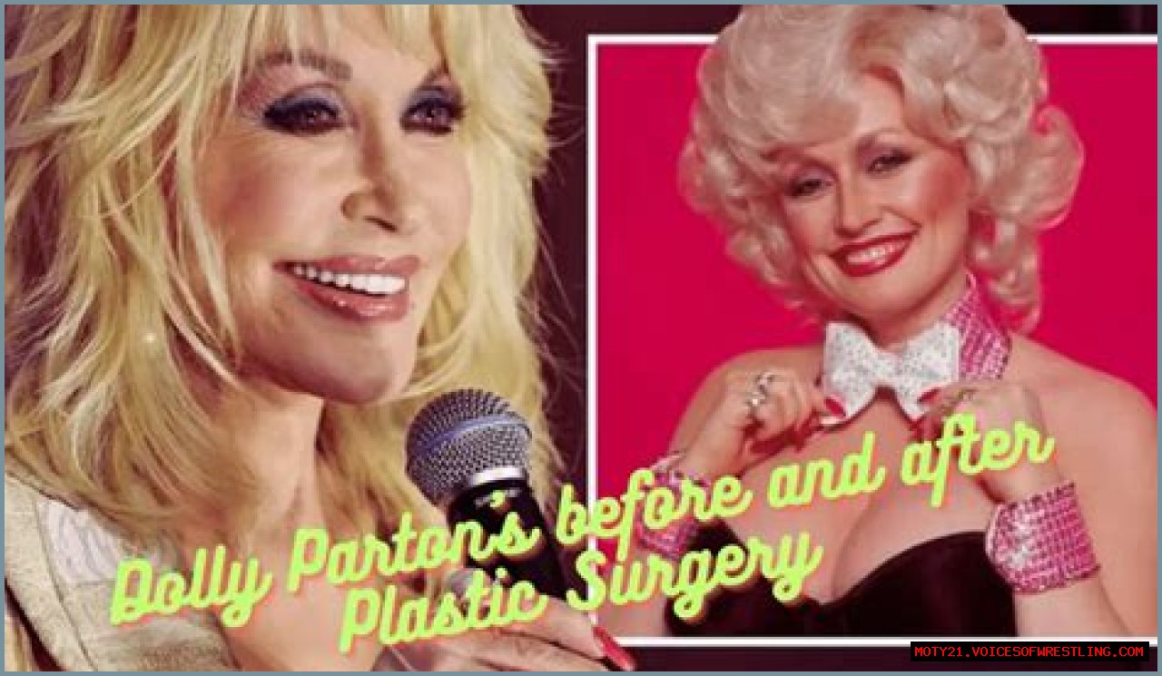 Dolly Parton Plastic Surgery revealed: When the bold star speaks