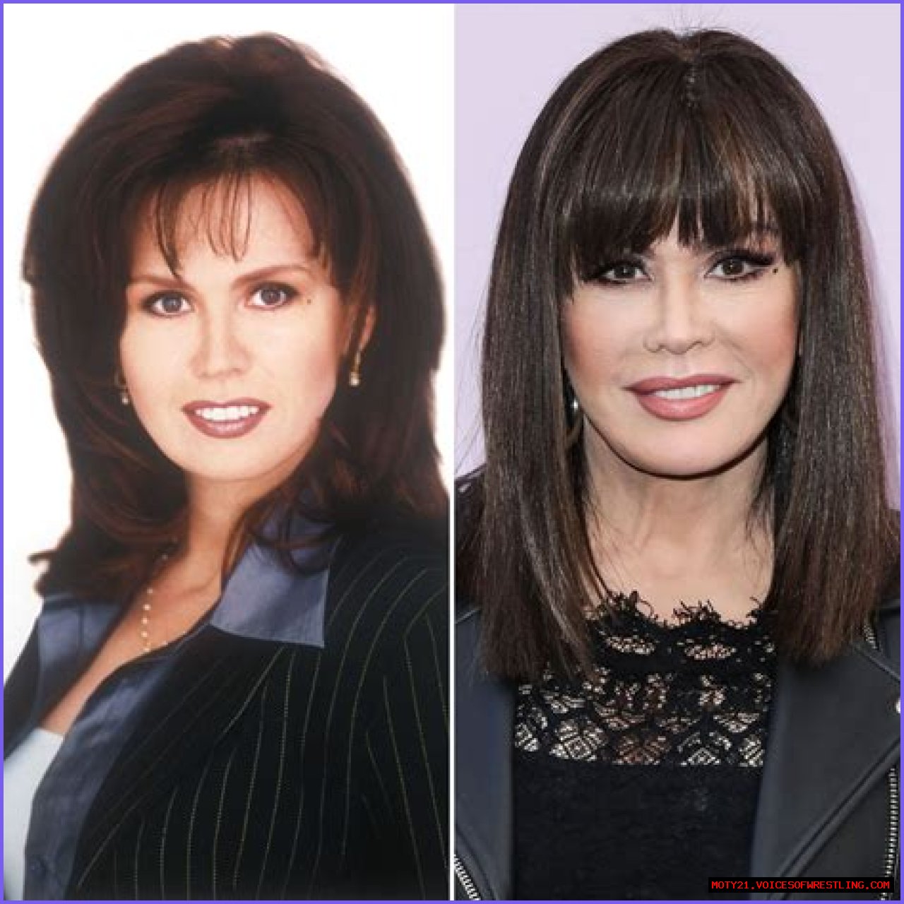 Has Marie Osmond Done Facelift And Plastic Surgery? Before And After Pics, Age And Height