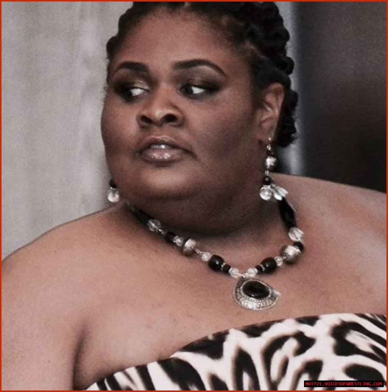 Katia Page: Who Was She? Battle with Lipoedema, Obituary, Death, Tribute, Family and More
