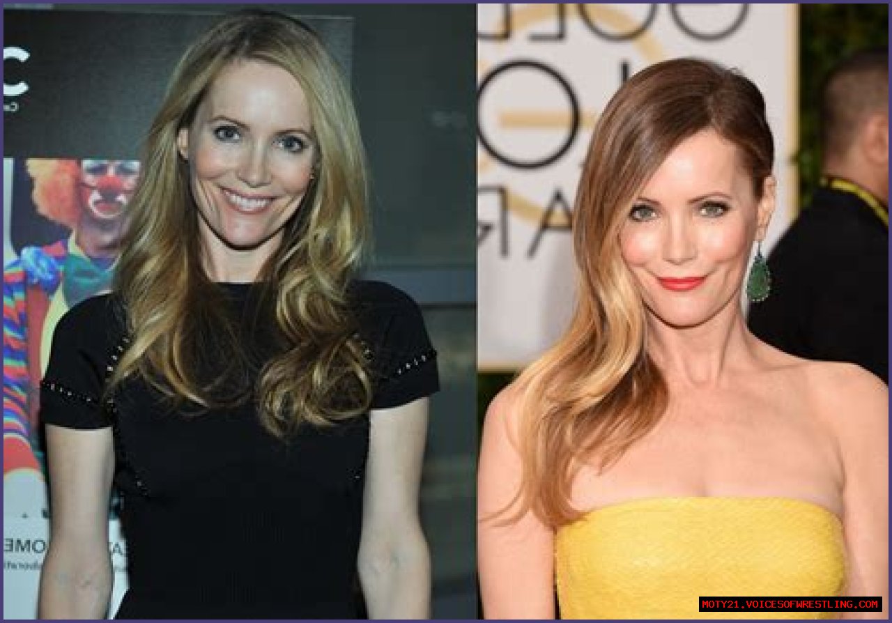 Leslie Mann Plastic Surgery Before and After
