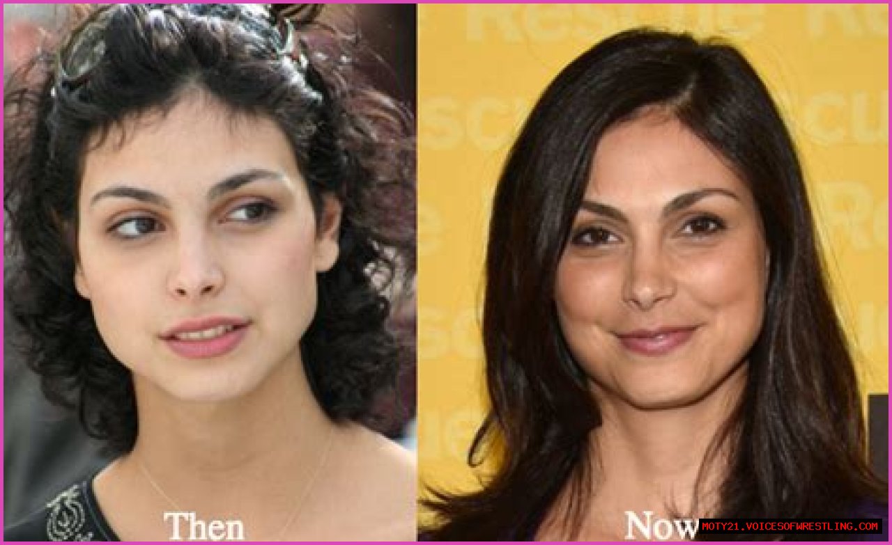 Morena Baccarin Plastic Surgery Before and After