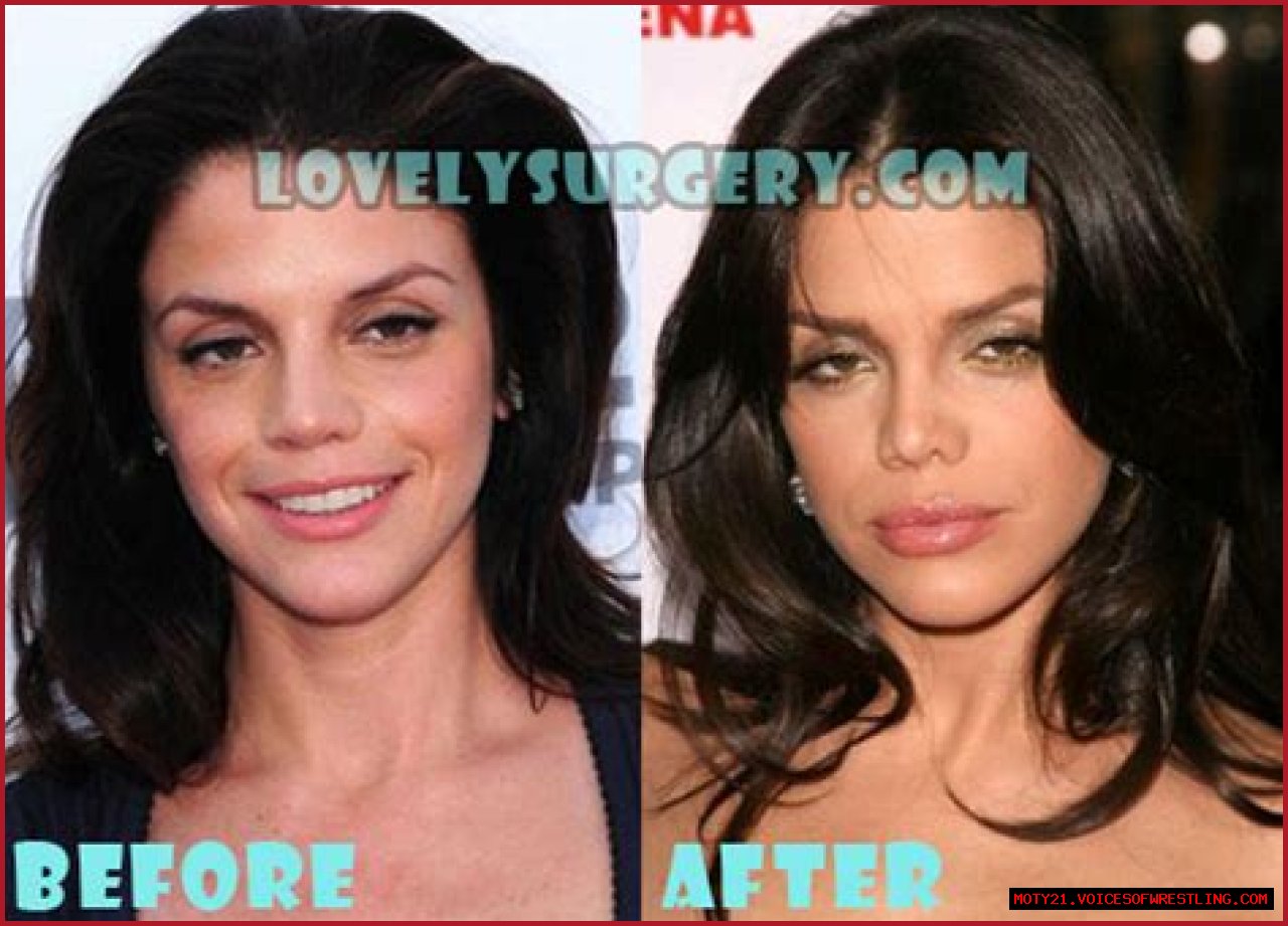 Vanessa Ferlito Plastic Surgery Before and After